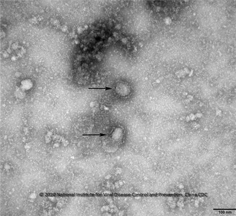 ▲ 전자현미경으로 관찰한 중국 우한 코로나바이러스 ⓒ 중국 위생건강위원회