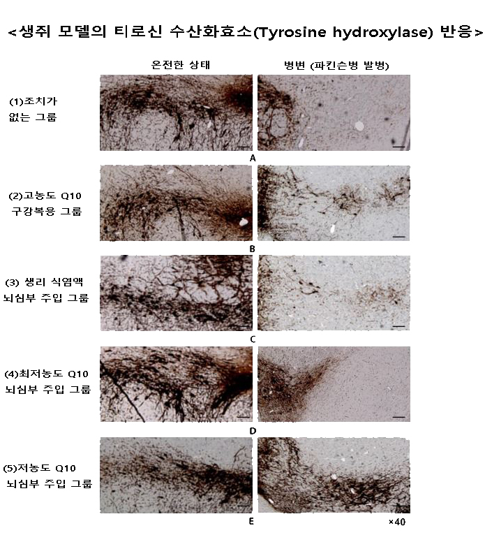 ▲ 그룹별 온전한 병변 부위의 티로신 수산화효소 반응을 나타낸 그림. 티로신 수산화효소가 잘 관찰될수록 도파민 신경세포 손상이 적음을 의미한다. ⓒ 서울대병원