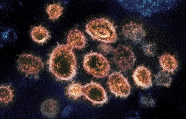 ▲ 인체에 감염된 코로나 바이러스의 전자현미경 사진.  ⓒ AP