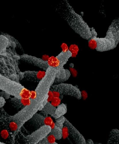 ▲ 배양 세포의 표면에서 빠져나오는 신종 코로나바이러스(적색)의 주사형 전자현미경 이미지. ⓒ 미국 NIAID(국립 알레르기 감염병 연구소)