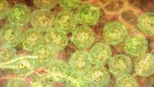 ▲ 염증 신호를 받아 항체(갈색)를 형성하는 B세포(녹색) ⓒ 호주 월터 & 엘리자 홀 의학 연구소