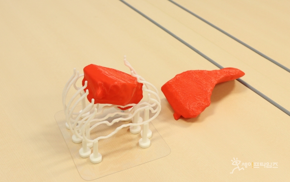 ▲ 소아 간 3D 프린팅 모델. ⓒ 삼성서울병원