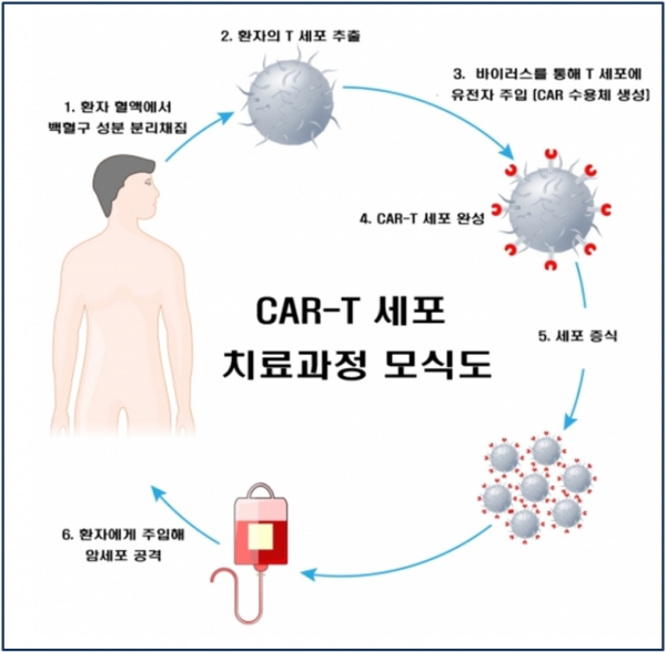 ▲ CAR-T 세포 치료과정 모식도. ⓒ 서울대병원