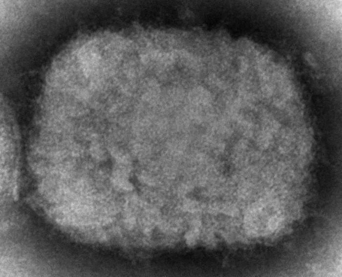 ▲ 원숭이두창 바이러스 현미경 사진 ⓒ AP 홈페이지 캡쳐