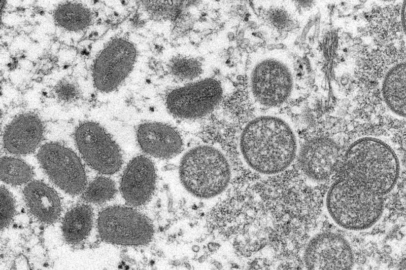 ▲ 원숭이두창 바이러스 전자현미경 사진. 왼쪽은 계란모양의 성숙한 원숭이두창 바이러스 입자들. 오른쪽은 공모양의 미성숙 바이러스 입자들 ⓒ AP홈페이지