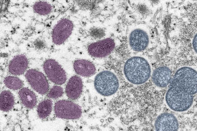 ▲ 원숭이두창 바이러스 전자현미경 사진. 왼쪽은 계란모양의 성숙한 바이러스 입자, 오른쪽은 공모양의 미성숙 바이러스 입자 ⓒ UPI 홈페이지