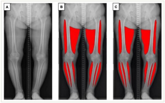 ▲ (A)원본 방사선 이미지 (B)전문의가 표시한 분절된 근육 (C)인공지능 모델이 예측한 분절된 근육. ⓒ 세이프타임즈