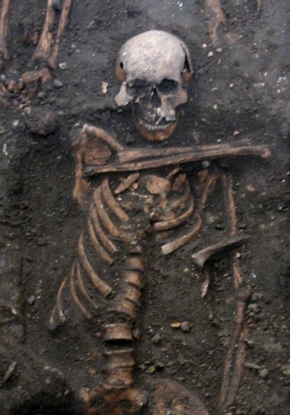 ▲ 고대 헤르페스 DNA 표본들 중 하나는 14세기 후반 성인 남성에서 채취되었는데, 그는 중세 케임브리지의 자선병원(후에 세인트존스칼리지가 됨) 부지에 묻혔다-그는 지독한 치아 농양을 앓고 있었다. ⓒ UPI
