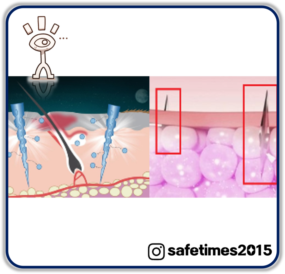 ▲ ⓒ 세이프타임즈