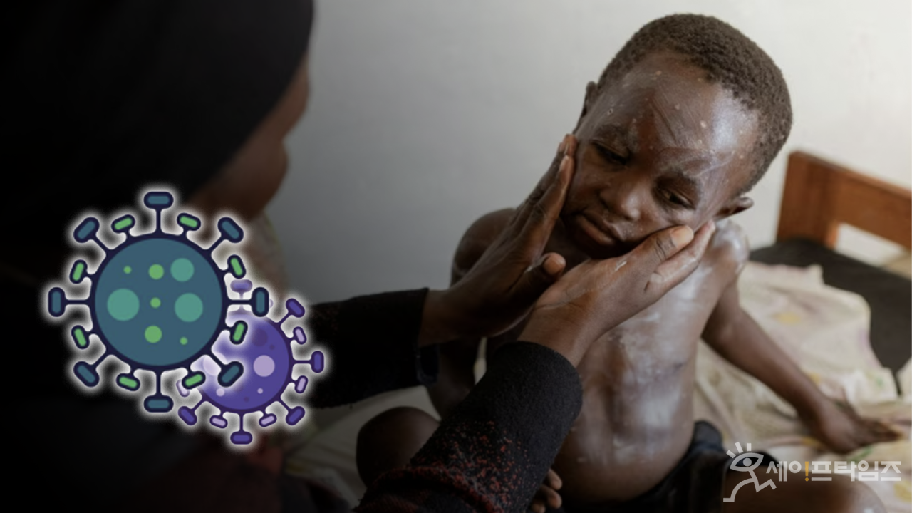 ▲ 콩고민주공화국에 독감과 같은 증세의 원인을 알 수 없는 감염병이 발생했다. ⓒ 세이프타임즈