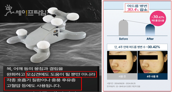 ▲ 부당한 의료제품 온라인 광고 적발사례. ⓒ 식약처